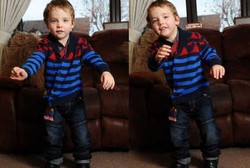 Bocah Ini Bisa Berjalan Lagi Berkat Donasi dari Keluarga yang Tak Dikenal