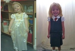 Gangguan Genetik, Tubuh Maci Bocah 6 Tahun Ini Seperti Anak 2 Tahun