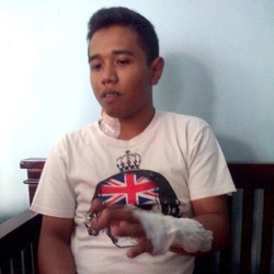 Detik-detik Aksi Sadis yang Dialami Deni di Pasupati