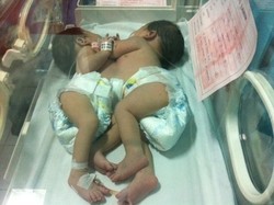 Kondisi Kian Menurun, Natalia Akhirnya Meninggal