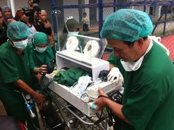 Bayi Natasia Menyusul Bayi Natalia, Meninggal Pasca Operasi Pemisahan