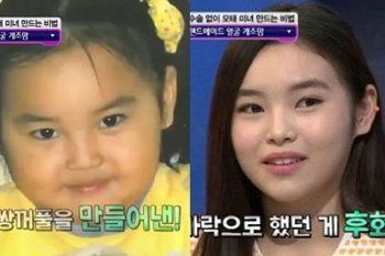 Bukan Operasi Plastik, Gadis Ini Jadi Cantik karena Pijat dan Sendok