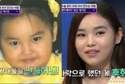 Hanya dengan Pijatan dan Sendok, Ibu Ini Ubah Wajah Putrinya Jadi Cantik