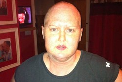 Dikira Pusing karena Dehidrasi, Wanita Ini Ternyata Idap Tumor Otak