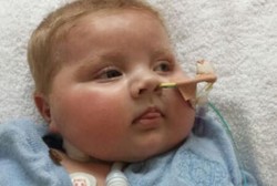 Ajaib, Jantung Bayi dengan Gangguan Arteri Langka Ini Bisa Sembuh Sendiri