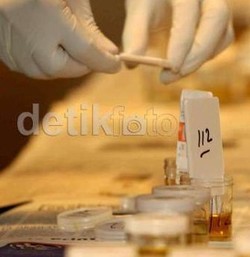 Rekayasa Kasus Narkoba, Ternyata Polisi Tak Mengetes Urine Rudy