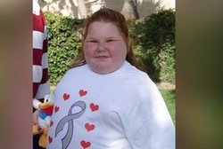 Pasca Operasi Tumor Otak, Anak Ini Jadi Ingin Makan Terus Menerus