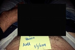 Mengaku Punya Kondisi Langka, Pria Ini Pamerkan Kemaluan Gandanya