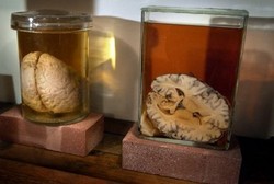 Tak Punya Uang, Pemuda Ini Nekat Curi Otak Manusia yang Diawetkan di Museum