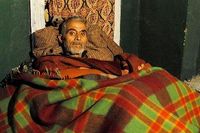 Mohammad Yousuf Khan, Kakek dengan Batu Kandung Kemih Raksasa