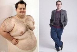 Perubahan Tubuh si Manusia Donat, Semula Super Gemuk Kini Jadi Ramping