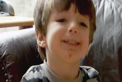 Bocah Ini Tak Bisa Berkedip Gara-gara Penyakit Langka