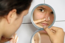 Bahan-bahan Alami yang Mujarab Hilangkan Bekas Jerawat