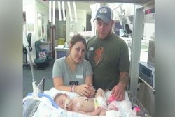 Dokter Kurang Hati-hati, Bayi Meninggal dengan Tengkorak Pecah Saat Lahir