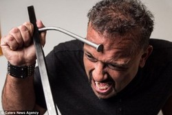 Pria Berkepala Palu, Tengkoraknya Kuat Memukul Paku dan Bengkokkan Logam