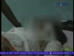 Menolak Dituduh Selingkuh, Seorang Pria Bakar Pacarnya