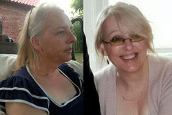 3 Tahun Pakai Kursi Roda, Wanita Ini Bisa Jalan Lagi Berkat Protein Shake