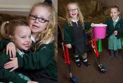 Tak Bisa Berjalan, Bocah Ini Malah Bantu Temannya agar Bisa Dioperasi