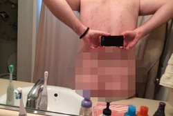 Tak Punya Belahan Pantat, Pria Ini Mengaku Punya Penyakit Parah