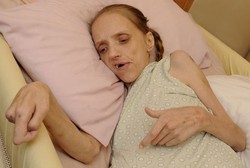 Minum 24 Kaleng Alkohol Tiap Hari, Wanita 35 Tahun Ini Sekarat