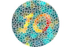 Pria Ini Klaim Buta Warnanya Sembuh Setelah Kepalanya Terbentur