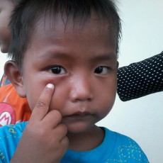 Tomcat Penyebab Kulit Melepuh Ganggu 470 Pengungsi Banjir di Koja