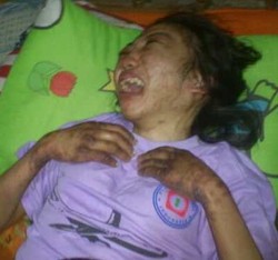 Dokter Forensik Hongkong Didatangkan untuk Periksa TKI Erwiana