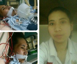 Lagi, TKW di Taiwan Disiksa Majikan Hingga Koma