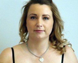 Cerita Claire yang Nyaris Meninggal karena Pasang Implan Payudara Murah