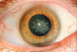 Kesetrum, Mata Pria Ini Jadi Ada Bintangnya