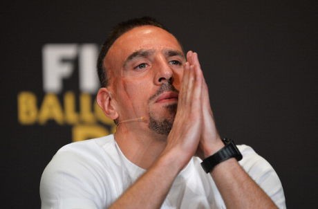 Bayern Mungkin Awali 2014 Tanpa Ribery
