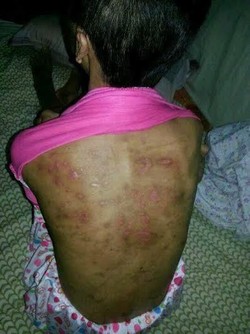 Sedih Lihat Nasib Kokom, di Saudi Dia Disiksa Majikan Kini Hidupnya Merana