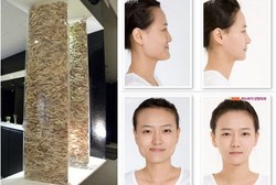 Sisa Tulang Rahang Pasien Operasi Plastik pun Jadi Karya Seni yang Unik