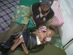 Kisah Sedih Azhar, Terbaring dengan Tubuh Kurus Kering karena Lumpuh Layuh