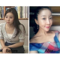 Bukannya Makin Cantik, Wajah Reporter Ini Terlihat Aneh Pasca Operasi Plastik