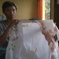 Gara-gara Saling Pandang, Tiga Siswa Kemala Bhayangkari Dikeroyok Kakak Kelas