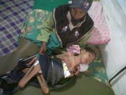 Kisah Sedih Azhar, Terbaring dengan Tubuh Kurus Kering karena Lumpuh Layuh