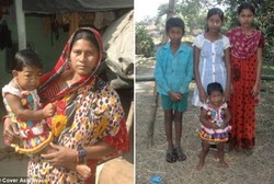 Ajifa Khatun, Umurnya 19 Tahun Tapi Terjebak di Tubuh Balita 2 Tahun