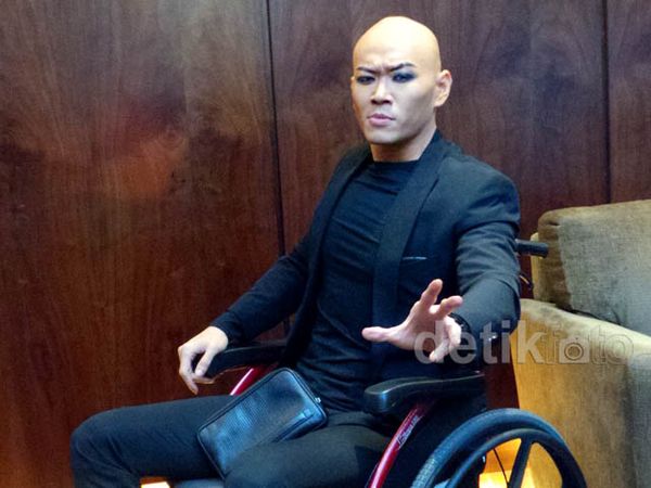 Deddy Corbuzier Duduk di Kursi Roda