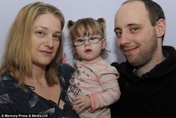 Kena Sakit Langka, Bocah Ini Bisa Meninggal Cuma Gara-gara Memar