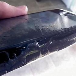 iPhone Meledak Akibatkan Luka Bakar Pemiliknya