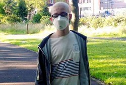 Terinfeksi Virus, Remaja Laki-laki Ini Tak Boleh Dekat-dekat Ibu Hamil