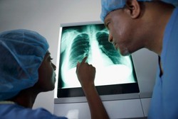 Studi: Paru-paru Perokok Juga Bisa Jadi Organ Donor