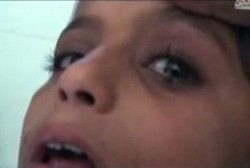 Aneh Tapi Nyata, Seorang Gadis Keluarkan Air Mata Batu Saat Menangis