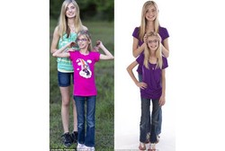 Sienna Tak Putus Asa Meski Lebih Pendek dari Kembarannya Akibat Kondisi Langka