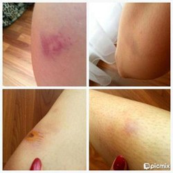 Kesurupan di Lokasi Syuting, Roro Fitria Alami Lebam