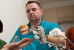 Tangan Bionik, Tangan Palsu yang Bisa Merasakan Tekstur dan Ukuran Sesuatu