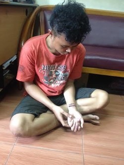 Ini Sony, Pemuda yang Tangannya Dipotong karena Curi Rokok di Tambora