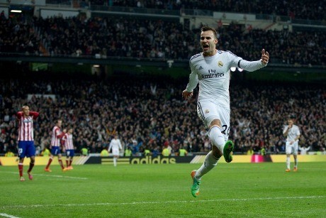 Ancelotti Bakal Hati-hati Tangani Jese