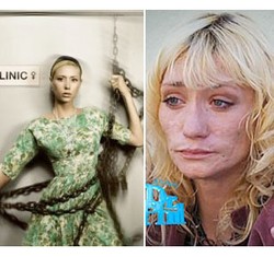 Ini Efek Buruk Obat-obatan Terlarang Terhadap Wajah Selebriti